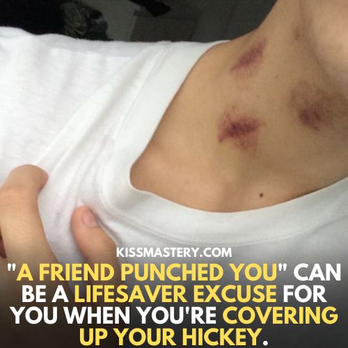 A friend punched you can be a lifesaver excuse for you when you are covering up your hickey