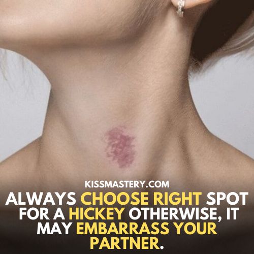 Always choose right spot for a hickey otherwise it may embarrass your partner