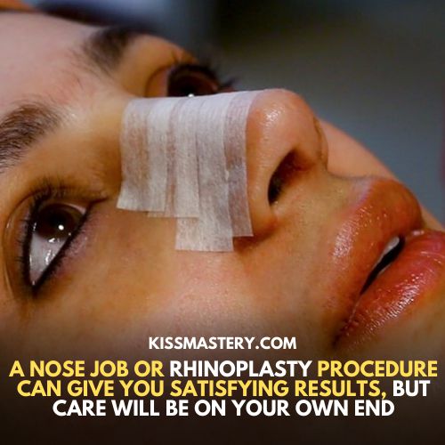 nose kiss after the nose job - rhinoplasty